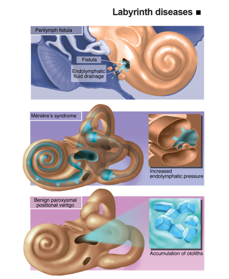 Infografis labirin